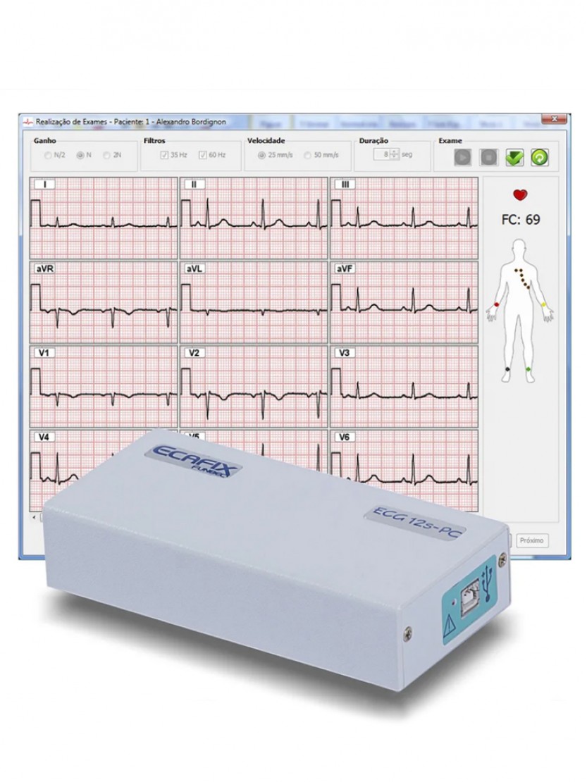 Eletrocardiógrafo Computadorizado ECG-12s PC popup